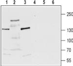 TRPM3 (extracellular) Antibody in Western Blot (WB)