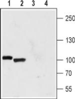 PKD2 Antibody in Western Blot (WB)