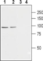 CACNB2 Antibody in Western Blot (WB)