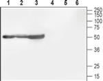 CACNB1 Antibody in Western Blot (WB)