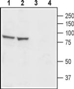 CATSPER1 (extracellular) Antibody in Western Blot (WB)