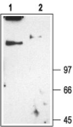 CLCN1 Antibody in Western Blot (WB)