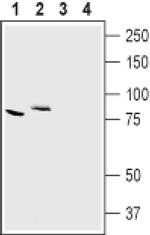 CLCN7 Antibody in Western Blot (WB)