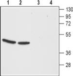 CCKBR (extracellular) Antibody in Western Blot (WB)