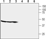 CRHR1 (extracellular) Antibody in Western Blot (WB)