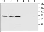 SLC5A7 (extracellular) Antibody in Western Blot (WB)