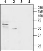 SLC22A1 Antibody in Western Blot (WB)