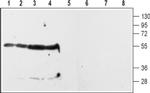 DRD2 (extracellular) Antibody in Western Blot (WB)