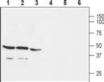 GPR30 Antibody in Western Blot (WB)