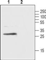 GPR40 (extracellular) Antibody in Western Blot (WB)