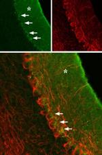 GABRA3 (extracellular) Antibody in Immunohistochemistry (IHC)