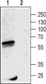GABRR1 (extracellular) Antibody in Western Blot (WB)
