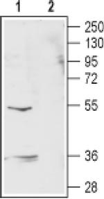 GABRR2 (extracellular) Antibody in Western Blot (WB)