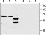 GABRA4 (extracellular) Antibody in Western Blot (WB)