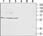 GABRD (extracellular) Antibody in Western Blot (WB)