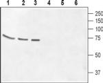 GABRQ (extracellular) Antibody in Western Blot (WB)