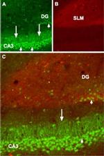 GABBR1 (extracellular) Antibody in Immunohistochemistry (Frozen) (IHC (F))
