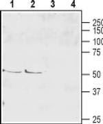 SLC1A6 (extracellular) Antibody in Western Blot (WB)