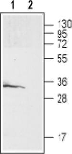 GALR3 (extracellular) Antibody in Western Blot (WB)