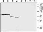 GIPR (extracellular) Antibody in Western Blot (WB)