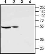 GnRHR (extracellular) Antibody in Western Blot (WB)