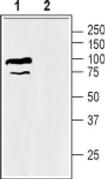 SLC6A12 Antibody in Western Blot (WB)