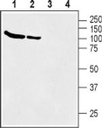 SLC6A12 Antibody in Western Blot (WB)