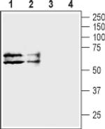 TAUT Antibody in Western Blot (WB)