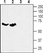SLC6A7 Antibody in Western Blot (WB)