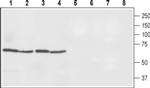 Ferroportin Antibody in Western Blot (WB)