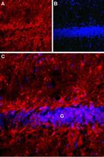 LPHN1 (extracellular) Antibody in Immunohistochemistry (IHC)