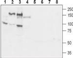 GP130 (extracellular) Antibody in Western Blot (WB)
