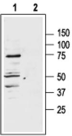 MC1R Antibody in Western Blot (WB)