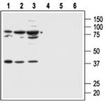 MC1R Antibody in Western Blot (WB)