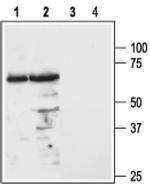 MC3R (extracellular) Antibody in Western Blot (WB)