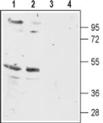 MC5R Antibody in Western Blot (WB)