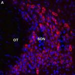 MTNR1B Antibody in Immunohistochemistry (Frozen) (IHC (F))