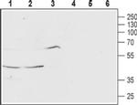 MCHR1 (extracellular) Antibody in Western Blot (WB)