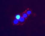 Norepinephrine Transporter (extracellular) Antibody in Immunocytochemistry (ICC/IF)