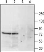 Norepinephrine Transporter (extracellular) Antibody in Western Blot (WB)