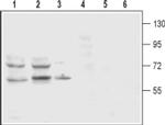Dopamine Transporter (extracellular) Antibody in Western Blot (WB)