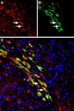 VMAT2 Antibody in Immunohistochemistry (Frozen) (IHC (F))