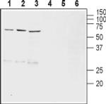 VMAT2 Antibody in Western Blot (WB)