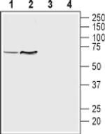 SLC18A1 Antibody in Western Blot (WB)