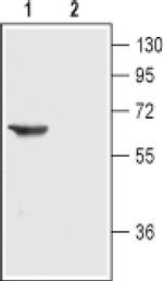 CHRNA3 (extracellular) Antibody in Western Blot (WB)