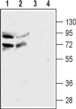 CHRNA4 (extracellular) Antibody in Western Blot (WB)