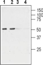 CHRNA6 (extracellular) Antibody in Western Blot (WB)