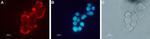 CHRNB2 (extracellular) Antibody in Immunocytochemistry (ICC/IF)