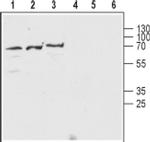 CHRNB2 (extracellular) Antibody in Western Blot (WB)