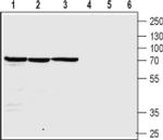 CHRNB4 (extracellular) Antibody in Western Blot (WB)